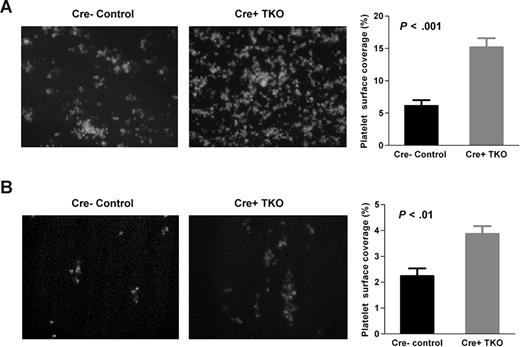Figure 4. Significantly more Cre+ TKO platelets adhered and aggregated on collagen matrices under physiologic flow conditions. Heparinized whole blood from Cre+ TKO and Cre− control mice was perfused over a collagen type III surface at a shear rate of 500 seconds−1 (A; 32×/0.40 NA objective) or a collagen type I surface at a shear rate of 1800 seconds−1(B; 60×/0.90 NA water objective). The percentage of surface coverage was significantly higher in perfusion at both lower and higher shear rates in TKO whole blood compared with Cre− controls. Representative pictures of platelet adhesion/aggregation in whole blood (left; n = 9).