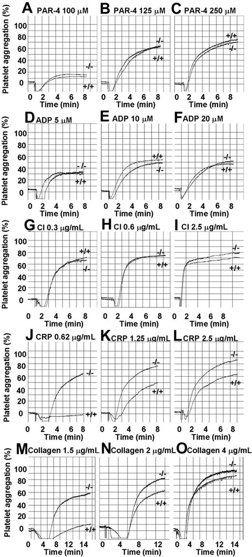 Figure 4. ceacam1−/− platelets show hyper-responsive aggregation in response to stimulation with GPVI-selective agonists. Aggregation responses of PRP (platelet count adjusted to 100 × 109/L) for wild-type and ceacam1−/− mice were determined after activation with different concentrations of various agonists: PAR-4 agonist peptide (100-250 μM), ADP (5-20 μM), calcium ionophore (0.3-2.5 μg/mL), collagen-related peptide (0.62-2.5 μg/mL) and collagen (1.5-4 μg/mL) respectively. Note that ceacam1−/− platelets are hyper-responsive in collagen and CRP-induced platelet aggregation. These results are representative of at least 3 independent experiments.