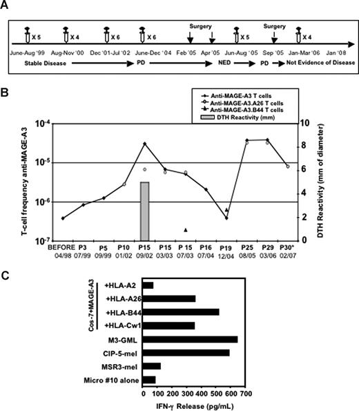 Figure 5. Enumeration and characterization of circulating anti–MAGE-A3 T cells in patient CIP-5. (A) Clinical evolution of patient CIP-5 and timing of treatments; PD: progressive disease, NED: not evidence of disease. (B) Frequency of circulating anti–MAGE-A3 T cells estimated in patient CIP-5 during the treatment. The frequency of total anti–MAGE-A3 T cells was measured as described in Figure 2. The frequency of anti–MAGE-A3.A26 and anti–MAGE-A3.B44 T cells was measured by tetramer staining or IFN-γ release assay, performed on multiple cultures of PBMCs (105) stimulated with the peptide M3250-258. After 15 infusions, patient CIP-5 developed a strong increase of circulating anti–MAGE-A3 T cells (3.08 × 10−5) that paralleled a MAGE-A3–specific DTH reaction; P stands for after infusion. (C) HLA-I restriction of the selected CD8+ microculture no. 10. HLA-I restriction was characterized as described in Figure 1. Microculture no. 10 recognized HLA-A26, -B44 and Cw01-restricted MAGE-A3–derived epitopes and autologous tumor cells (CIP-5-mel). Autologous lymphocytes expressing MAGE-A3 (M3-GMLs) were used as positive control.