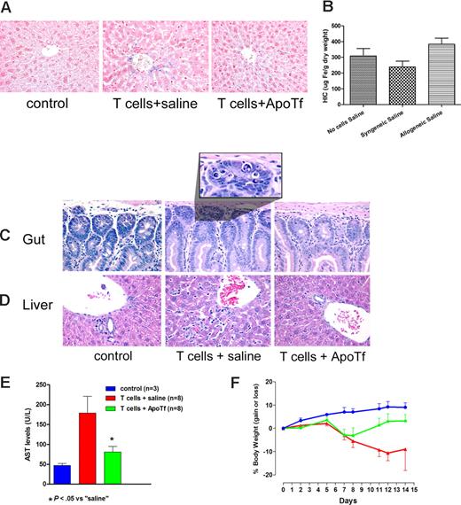 Figure 1. Protective effect of apotransferrin against tissue injury induced by allogeneic T cells. Iron accumulation in the liver and hepatic and intestinal injury after transplantation of allogeneic T cells to NOD/SCID mice. (A) NOD/SCID mice (H-2d) underwent transplantation with 3 × 107 allogeneic lymphocytes from C57BL6 mice (H-2b), following injection of saline (middle panel) or human apotransferrin (1 mg/mouse; right panel) 24 and 2 hours before T-cell infusion. Livers from untreated mice served as additional controls (left panel). (B) Hepatic iron content (HIC) as determined by colorimetric assay (mean ± 1 SD) on day 14 after the infusion of saline and either no cells or syngeneic or allogeneic cells, respectively (3-8 mice per group). (C) Histology of the duodenum and (D) liver, representative for the 3 groups of mice described in panel A. (E) Serum transaminase levels (mean ± 1 SD) in controls (blue column) and mice on day 14 after infusion of allogeneic T lymphocytes after pretreatment with saline (red column) or apotransferrin (green column). (F) Weight changes in mice from panel E over the 14-day course of the experiment. Beyond day 7 body weight was significantly higher in ApoTf pretreated than in saline pretreated mice (P < .05 to P < .02 by Student t test, calculated on days 7 and 14).