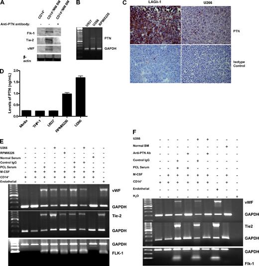 Figure 3. MM cells as well as PCL serum induce VEC gene and protein expression in monocytes that is blocked by anti-PTN antibodies. (A) Freshly obtained CD14+ cells cocultured with MM BM tumor cells with and without anti-PTN antibody were analyzed for Flk-1, Tie-2, and VWF protein expression using Western blot analysis. Haceks served as a positive control. (B) U937, U266, and RPMI8226 cells were analyzed for PTN and GAPDH gene expression with RT-PCR. (C) LAGλ-1 and U266 cells were stained with either anti-PTN or isotype-matched control antibodies. (D) THP-1, U937, RPMI8226, and U266 cells were cultured for 48 hours and the culture supernatant was analyzed for PTN protein concentration by ELISA. Data for PTN graphed are the average of experiments performed in triplicate and show means plus or minus SEM. (E) Endothelial cells (HCAECs) or CD14+ cells alone or exposed to M-CSF, the PTN-producing MM cell lines U266 and RPMI8226, or serum from a healthy control subject or a patient with PCL containing high levels of PTN (3.4 ng/mL)22 were analyzed for gene expression using primers specific for VWF, Tie-2, Flk-1, and GAPDH with RT-PCR. (F) Endothelial cells (HCAECs) or CD14+ cells alone or exposed to M-CSF, the PTN-producing MM cell line U266, or BM from a healthy control subject or serum from the patient with PCL were analyzed for expression of the VWF, Tie-2, and Flk-1 genes in the presence of anti-PTN or isotype-matched control antibodies.