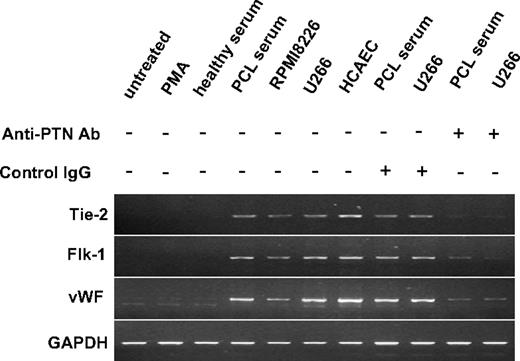 Figure 5. To determine whether PTN induced the monocyte cell line THP-1 to express VEC genes, total RNA was isolated and separated by 1% agarose gel electrophoresis after THP-1 monocytes were cultured with PMA, PCL serum, or normal human serum or cocultured with U266 and RPMI8226. In addition, THP-1 cells exposed to U266 or PCL serum were also treated with either anti-PTN or isotype-matched control antibodies during tissue culture. RT-PCR was performed on RNA from THP-1 cells with primers specific for the Tie-2, Flk-1, VWF, and GAPDH genes. HCAECs were used as a positive control.
