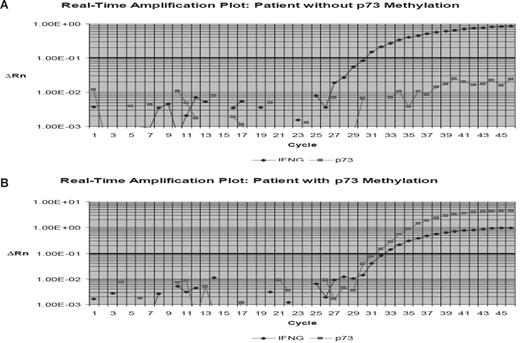 Figure 1. Example of p73 real-time bisulfite PCR. Hypermethylated p73 gene promoter region DNA detected by use of the ABI Prism 7000 Sequence Detection System (TaqMan). (A) Example of a patient with hypermethylated p73. (B) Example of a case without p73 methylation. p73 methylation was estimated in relation to the detection of the interferon-γ gene (IFNG). ΔRn is defined as the cycle-to-cycle change in the reporter fluorescence signal normalized to a passive reference fluorescence signal (log scale). The horizontal line represents the threshold. CT indicates cycle threshold, the cycle number at which the Rn exceeds the baseline by the value of the threshold.