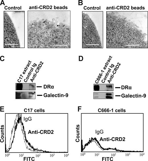 Figure 4. Galectin-9 CRD2 is presented at the surface of NPC exosomes. Low-density vesicles (110-kg pellets) released by C17 or C666-1 NPC cells were incubated with magnetic beads coated with the 9M1-3 monoclonal antibody directed to the CRD2 of galectin-9. Beads coated with purified isotype-matched nonspecific Ig were used for control reactions. (Top panel) Numerous exosomes released by C17 (A) or C666-1 (B) are captured by anti-CRD2, but not control beads, and visualized by electron microscopy. (Middle panel) Western blot analysis detects the DR-α and galectin-9 proteins in C17 (C) and C666-1 (D) exosomes, whereas no similar proteins are recovered from control beads coated with irrelevant IgG. Positive controls are provided by total C17 and C666-1 cell extracts in the left lanes of panels C and D, respectively. (Bottom panel) A small amount of the galectin-9 CRD2 is detected at the surface of live C17 cells by flow cytometry (E), whereas it is absent at the surface of C666-1 (F) cells.