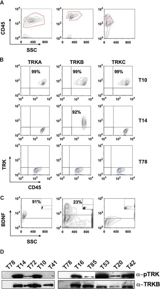 Figure 1. Expression of TRK receptors and NTs in patients with AL. (A) Showing the gate for the blast population. Left panel: patient T10 (AML M5). Middle panel: T14 (T-cell ALL). Right panel: patient T78 (AML M1). (B) Top row showing expression of all 3 TRK receptors in the blasts of patient T10. Middle row: patient T14 expressed only TRKB. Bottom row: patient T78 was negative for TRK receptors. (C) BDNF was also expressed in patients T10 (left panel) and T14 (middle panel), but not in patient T78 (right panel). The isotype controls are shown as insets. (D) Constitutive phosphorylation of p145TRK in primary leukemic cells. Total cell lysates were blotted and probed with an anti-pTRK (E-6) antibody detecting phosphorylated forms of all 3 TRK receptors. The blot was stripped and reprobed with the anti-TRKB (794) antibody. Please see flow cytometry diagrams in Figures S1 and S3 showing expression of TRKs and BDNF in the blasts of the patients not shown here.