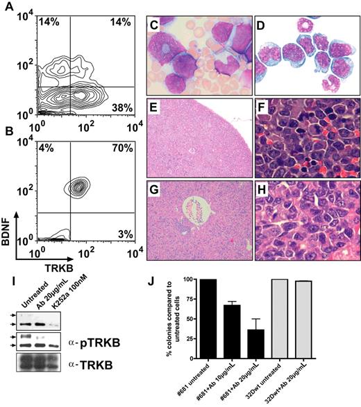 Figure 4. Development of leukemia in mouse no. 681 that received a transplant of TRKB- and BDNF-modified hematopoietic cells (32D). FACS analysis showing coexpression of TRKB and BDNF before transplantation (A) and in myeloid blasts recovered from the animal (B). (C) Peripheral blood smear showing marked leukocytosis consisting predominantly of immature myeloid cells. (D) Cytospin of BM showing myeloblasts with an abundant cytoplasm (×1000). (E,F) Diffuse myeloblastic infiltration in spleen and complete effacement of its normal structure (×100, ×1000). (G,H) Extensive infiltration of leukemic cells in liver, primarily in portal areas, but also diffusely in the sinusoid (×100, ×1000). (I) Constitutive activation of TRKB in leukemic cells and blocking of the TRKB/BDNF autocrine loop by anti–BDNF-neutralizingantibody and K252a. Leukemic cells were treated with either 20 μg/mL anti-BDNF antibody or 100 nM K252a for 12 hours. Total cell lysates (300 μg) from untreated and treated cells were immunoprecipitated with the anti-TRK (C-14), separated on SDS–polyacrylamide gel electrophoresis (PAGE), blotted, and probed with an anti-pTRK (E-6) antibody (top and middle panels with short and long exposition, respectively). The blot was stripped and reprobed with the anti-TRKB (H181) antibody. Arrows point to the phosphorylated forms of TRK. Note different expression pattern of human TRKB in human cells (only 145-kDa form in Figure 1) and rodent cells (both 145-kDa and 120-kDA forms) as previously described.51 (J) Antihuman BDNF antibody (10 μg/mL and 20 μg/mL) inhibited growth of leukemic cells in colony-forming assays. Results are presented as the average percentage of colonies formed in the presence of antibody (100% value derived from untreated control). Results presented are the mean plus or minus SD of 2 independent experiments.