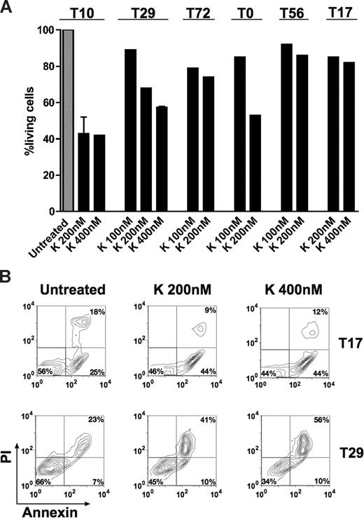 Figure 5. K252a induces apoptosis of primary AML cells. Cell viability was analyzed using the annexin-V assay. Results are presented as the percentage of living cells in the presence of K252a (100% value derived from untreated control). (A) Cells were from patient T72 expressing TRKB and BDNF, both patients T10 and T29 expressing TRKs (TRKA, TRKB, and TRKC) and BDNF, and T0 (only TRKs). Patients T17 and T56 were negative for TRKs and NTs. Results presented for T10 (K 200 nM) and T29 (K 400 nM) are the mean plus or minus SD of 2 independent experiments. Note that treatment schedule was not completely applied to all patients tested due to limited number of cells. The concentrations of K252a that we used have been well documented for TRK inhibition in the literature.17,49,50 K indicates K252a. (B) Flow cytometric diagram of apoptosis of blasts from patient T17 and T29, cultured with K252a for 18 hours before analysis.