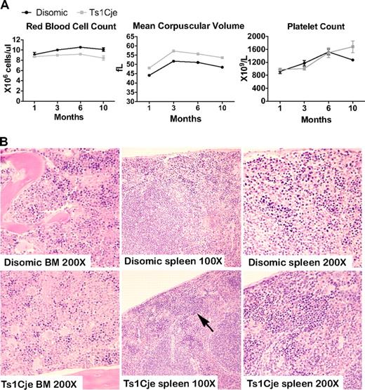 Figure 2. Phenotypic analysis of hematopoiesis in Ts1Cje postnatal mice detects peripheral blood abnormalities. (A) Ts1Cje mice at 1, 3, 6, and 10 months display abnormalities in the red cell lineage. (For each genotype at each age, n > 7, except 10 months, when n = 4). Platelet counts, however, are normal at all 4 ages and P < .001 for red blood cell count at 3 and 6 months, and for mean corpuscular volume at all 4 ages. (B) Sternum and spleen sections from 2-month-old Ts1Cje and disomic control mice. Slightly increased numbers of nucleated erythrocytes (arrow) were observed in the Ts1Cje spleen, and reduced numbers were present in the BM. BM images: original magnification ×200; spleen, original magnification ×100 and ×200. Sections are representative of 3 mice per genotype.