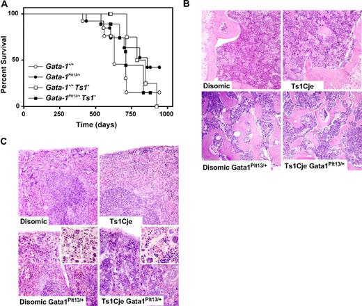 Figure 4. Ts1Cje mice, with or without Gata1 mutation, do not develop a myeloproliferative disorder. (A) Disease incidence was monitored in a cohort of Ts1Cje mice, and in Ts1Cje mice that carried a loss of function exon 2 mutation in Gata1 (Gata1Plt13), over a 2-year period (n = 9-13 mice of each genotype). Mice were killed when they exhibited signs of illness, and an autopsy and histologic analysis were performed. Ts1Cje mice had a similar life expectancy to disomic mice (○, □). The presence of the Gata1Plt13 mutation did not significantly alter the survival curve of Ts1Cje mice, nor did it alter the disease spectrum (●, ■). (B) BM sections (original magnification ×100) from 2-year-old Ts1Cje mice. The Gata1Plt13 mutation normally leads to increased numbers of megakaryocytes and bone overgrowth in the BM. Crossing this mutation onto the Ts1Cje background did not alter this phenotype. (C) Spleen sections (original magnification ×100) from aged mice also did not show any signs of myelofibrosis in Ts1Cje mice. The Gata1Plt13 mutation normally leads to increased numbers of megakaryocytes in the spleen, and this frequency was not altered by crossing to the Ts1Cje mice (insets; original magnification ×200).