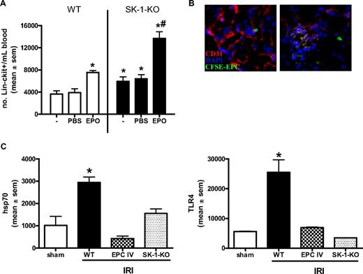 Figure 7. EPC mobilization is enhanced in SK-deficient mice and protects against ischemic injury. (A) WT and SK-1-KO mice, no treatment (−) or administered with PBS or EPO (1000 IU/kg) for 3 consecutive days. Circulating blood was collected and Lin−/c-kit+ cells isolated by magnetic sorting. Results show the mean plus or minus SEM of cell numbers from at least 3 mice in each group. *P < .05, compared with WT PBS. #P < .05, compared with SK-1-KO PBS. (B) CFSE-labeled EPCs injected intravenously into WT mice after kidney ischemia and visualized after 24 hours of reperfusion. Frozen tissue sections stained for CD31 (red) and DAPI (blue) allowed visualization of kidney vasculature as well as recruited CFSE-EPCs (green) by fluorescence microscopy. (C) mRNA levels of hsp70 and TLR4 were investigated in ischemic kidneys 24 hours after IRI by quantitative RT-PCR. Expression is normalized to their GAPDH gene, and results show the mean plus or minus SEM for 5 mice in each group. *P < .05, 1-way analysis of variance, compared with sham controls.