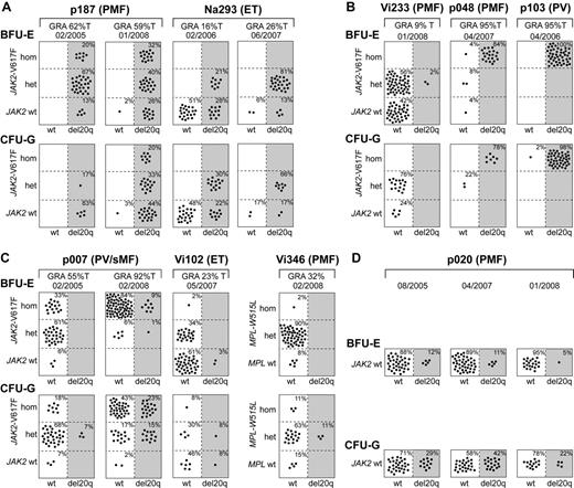 Figure 3. Single colony assays for del20q and JAK2-V617F. PBMCs were grown in methylcellulose in the presence of erythropoietin. Single erythroid colonies (BFU-E) and granulocytic colonies (CFU-G) were picked and analyzed individually for the presence of del20q and JAK2-V617F by microsatellite PCR and allele-specific PCR, respectively. Each colony is represented by a dot that is placed into one of 6 quadrangles representing the 6 possible genotypes: wild-type (wt), heterozygous (het), and homozygous (hom) for JAK2-V617F or MPL-W515L on the vertical axis, and absence (open quadrangles) or presence of del20q (gray quadrangles) on the horizontal axis. Results for BFU-Es are shown in the upper part and CFU-Gs in the lower part of the panels. The unique patient numbers, the diagnoses (PMF, ET, PV, sMF indicates secondary myelofibrosis), the allelic ratio of JAK2-V617F or MPL-W515L in purified granulocytes (%T), and the date of the sample drawing are shown above the corresponding boxes. (A) This group of patients has acquired the del20q before JAK2-V617F, as demonstrated by the presence of JAK2 wt colonies carrying del20q. For both patients shown, 2 sequential samples were analyzed. (B) In this group of patients, del20q was acquired in a cell already carrying JAK2-V617F, as indicated by the presence of JAK2-V617F-positive colonies with or without del20q. (C) Patients with a complex pattern of del20q acquisition that does not comply with a linear temporal order of events. In patient Vi346, the del20q coexists with MPL-W515L. (D) A patient with del20q that is negative for the JAK2-V617F mutation.