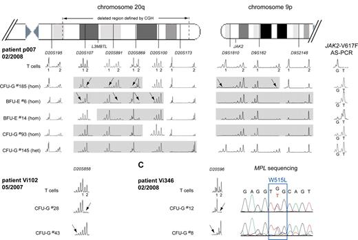 Figure 4. Multiple del20q and 9pLOH events in colonies from 3 MPD patients. (A) The deleted region on chromosome 20q was mapped in individual colonies from patient p007 using 6 microsatellites distributed along chromosome 20q. T-cell DNA was used to define the 2 alleles for each informative microsatellite. The gray boxes mark the deleted region for each individual colony. del20q in colony no. 185 created a different haplotype than the deletion in colony no. 6 (marked by arrows), indicating that 2 del20q events occurred independently and affected the chromosome 20q of different parental origin. Furthermore, 4 different sizes of the del20q haplotype were detected when additional colonies were analyzed. The results from the mapping of the 9pLOH region are shown on the right side. The 9pLOH region is smaller in colony no. 185, as shown by the heterozygosity of D9S2148 in this colony. (B) Two separate del20q events affecting the chromosome 20q of different parental origin occurred in patient Vi102. (C) Two separate del20q events affecting the chromosome 20q of different parental origin occurred in patient Vi346. The chromatograms for the MPL-W515L mutation are shown for the 2 colonies analyzed.
