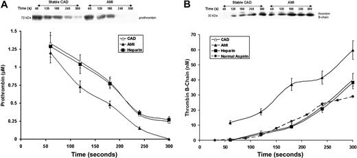 Figure 3. Prothrombin consumption and thrombin formation. (A) Prothrombin activation in bleeding-time blood. A representative immunoblot of prothrombin on a nonreduced gel (5%-15%) from a patient with stable CAD and a patient with AMI. Prothrombin concentrations, determined by quantitative densitometry of immunoblots, are presented as a function of time (seconds) for all patients in each cohort; stable CAD (▵, n = 28), AMI (▴, n = 28), and heparin-treated AMI (■, n = 8). Data are plotted as means plus or minus SEM. (B) A representative reduced immunoblot (5%-15%) for thrombin B-chain formation in bleeding-time blood. Thrombin B-chain concentration is presented as a function of time (seconds) for patients with stable CAD (▵, n = 28), AMI (▴, n = 28), and heparin-treated AMI (■, n = 8). Data are plotted as means plus or minus SEM. Historic data for healthy individuals on aspirin (●, ) are presented for comparison.