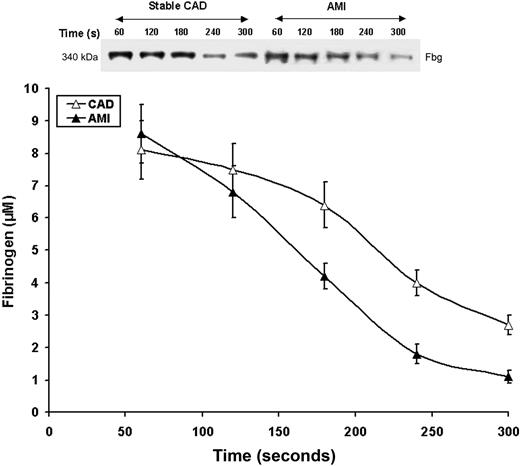 Figure 6. Fibrinogen consumption. Representative nonreduced immunoblot (5%-15%) of fibrinogen from consecutive 60-second bleeding-time blood samples for a stable CAD patient and a patient with AMI. Fibrinogen concentrations were determined by densitometry of immunoblots as described in “Fibrinogen consumption.” Data for all CAD patients (n = 28, ▵) and AMI patients (n = 28, ▴) are plotted as the means plus or minus SEM.