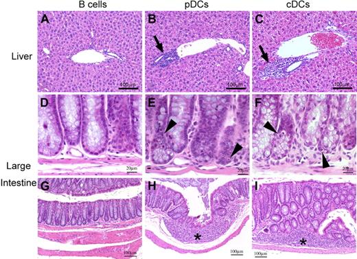 Figure 3. pDCs or cDCs alone mediate standard acute GVHD. Histologic findings of the liver (A-C) and large intestine (D-I). Periportal mononuclear infiltrates in the liver (panels B,C), and crypt cell apoptosis (panels E,F) and granulation tissue (* in panels H,I) in the large intestine are shown.