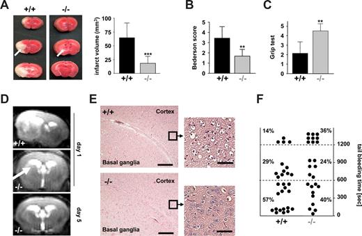 Figure 4. Orai1−/− chimeras are protected from cerebral ischemia without displaying major bleeding. (A left panel) Representative images of 3 corresponding coronal sections from control and Orai1−/− chimeras mice stained with TTC 24 hours after tMCAO. Infarct areas are marked with arrows. (Right panel) Brain infarct volumes in control (n = 7) and Orai1−/− chimeras (n = 7); ***P < .001. (B,C) Neurologic Bederson score and grip test assessed at day 1 following tMACO of control (n = 7) and Orai1−/− chimeras (n = 7); **P < .01. Error bars represent plus or minus SD. (D) The coronal T2-w MR brain image shows a large hyperintense ischemic lesion at day 1 after tMCAO in controls (left). Infarcts are smaller in Orai1−/− chimeras (middle, white arrow), and T2 hyperintensity decreases by day 5 during infarct maturation (right). Importantly, hypointense areas indicating intracerebral hemorrhage were not seen in Orai1−/− chimeras, demonstrating that Orai1 deficiency does not increase the risk of hemorrhagic transformation, even at advanced stages of infarct development. (E) Hematoxylin and eosin–stained sections of corresponding territories in the ischemic hemispheres of control and Orai1−/− chimeras. Infarcts are restricted to the basal ganglia in Orai1−/− chimeras but consistently include the cortex in controls. Magnification, 100×-fold and ×400 (10×/0.3 NA and 40×/0.75 NA objectives; Carl Zeiss, Heidelberg, Germany). Bars represent 300 μm (left) and 37.5 μm (right). (F) Bleeding time is only mildly prolonged in Orai1−/− chimeras after amputating the tail tip of anesthetized mice. Each dot represents 1 individual.