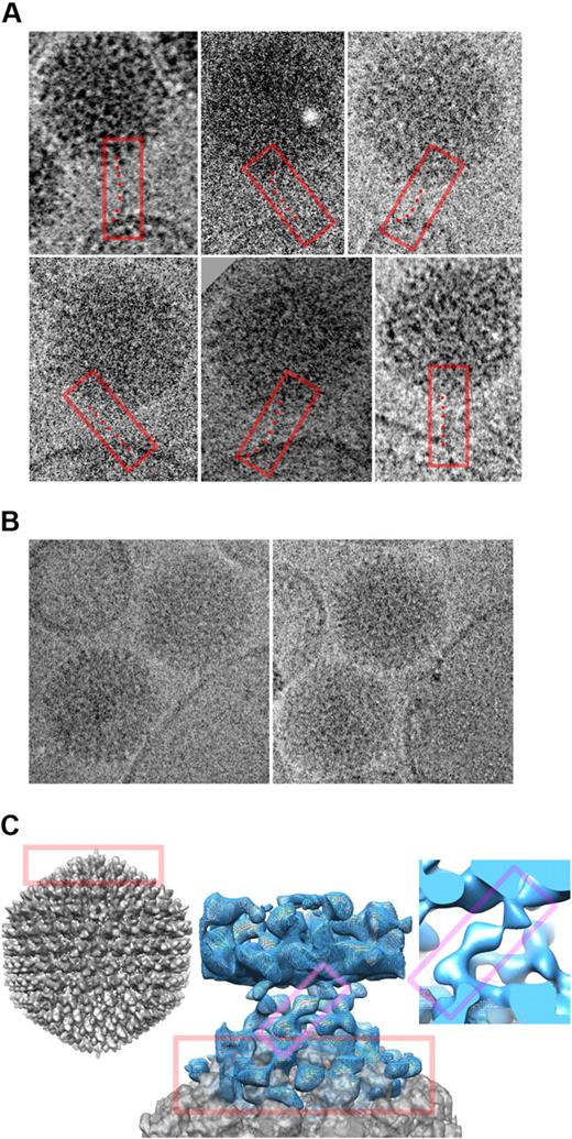 Figure 4. The binding of Ad5 to erythrocytes can be visualized by cryo-electron microscopy. Erythrocyte ghosts were exposed to Ad5 for 30 minutes before fixation and imaging. (A) Gallery of 6 images of Ad5 interacting peripherally with human erythrocyte ghost membranes in PBS. In each case, the tubular density visible for the pentagonal vertex fiber is boxed in red, with a series of points marking the flexible path of the fiber from the Ad5 surface above to the membrane below. (B) Images of Ad5 and ghost membranes in close association in PBS. (C) Central image shows a reconstruction of the close interaction of Ad5 with the human ghost membrane. The planar membrane (blue density mesh) forms the top part of the image, and the curved pentagonal vertex of the Ad5 (gray density surface) the bottom portion. They are linked by a crown of obliquely oriented features. The Ad5 portion of the image is superimposed with the equivalent portion of a whole-Ad5 reconstruction, for comparison.21 The whole Ad5 is shown to the left (gray density), in the same orientation as in the middle panel, with equivalent portions in the 2 boxed in red. A closeup of one connection is shown to the right, and equivalent portions of it and the central image are boxed in magenta.