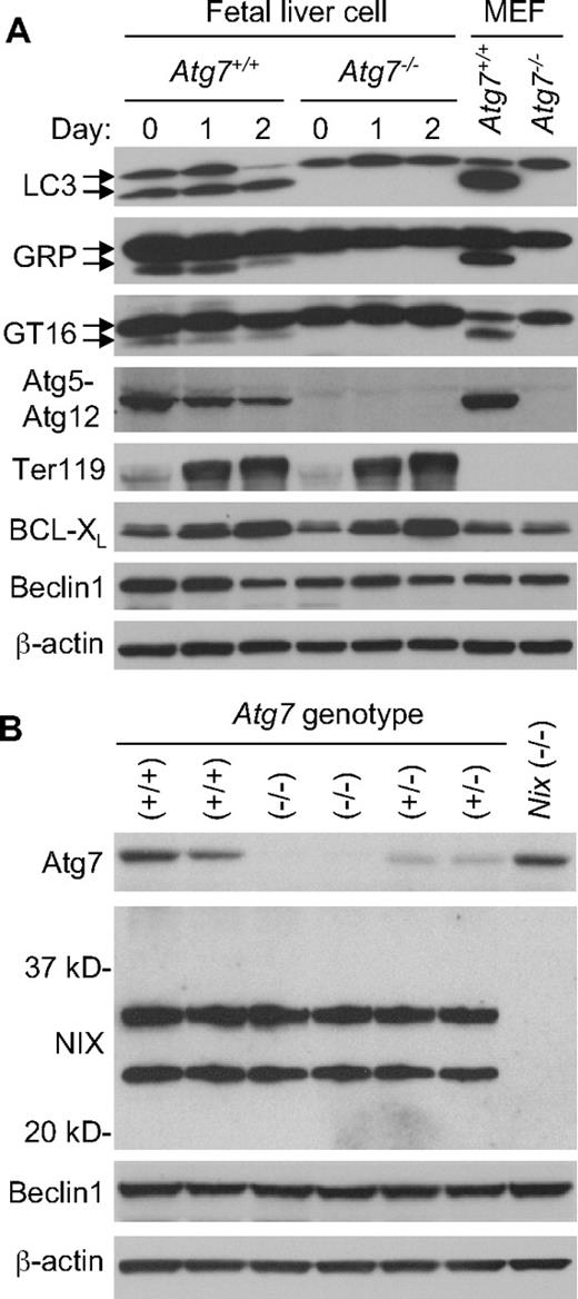 Figure 3. Deficient ubiquitin-like conjugation activity in Atg7−/− erythroid cells. (A) Western blot analyses of LC3, GABARAP (GRP), GATE-16 (GT16), Atg12, Ter119, BCL-XL, Beclin-1, and β-actin in expanded E14.5 fetal liver cells undergoing differentiation in culture for 2 days. The upper LC3 band corresponds to the unconjugated form of LC3, and the lower band corresponds to the lipid conjugated form of LC3. This same is true for the other Atg8 homologs, GABARAP and GATE-16. Wild-type murine embryonic fibroblasts (MEF) provide a positive control for the position of the unconjugated and conjugated proteins. Genotypes and days in culture are indicated at the top. (B) Western blot analyses of Atg7, NIX, Beclin-1, and β-actin in primary E14.5 fetal liver cells. NIX protein is expressed as 2 isoforms in erythroid cells, a full-length monomeric form (top band), and a shorter isoform, which has not been fully characterized (bottom band). Beclin-1 is provided as a loading control. Genotypes are indicated at the top.