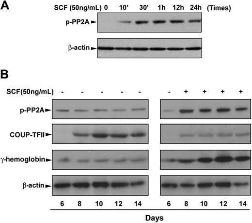 Figure 2. SCF-induced phosphorylation of PP2A correlates with increased fetal hemoglobin during erythroid differentiation. CD34+ cells were cultured in EPO-containing medium for 6 days before the addition of SCF. (A) Cells were incubated with SCF (50 ng/mL) for the indicated times, and whole cell lysates (30 μg) were analyzed by immunoblot for phosphorylation of PP2A. (B) Cells were incubated with SCF (50 ng/mL) from day 6 to day 14, and total cell lysates (30 μg) harvested on the indicated culture days were analyzed by immunoblot for phosphorylation of PP2A, COUP-TFII, or fetal hemoglobin expression. The lowest panel shows the same blot stripped and reprobed with total β-actin antibody to confirm that similar amounts of protein extracts were analyzed in each lane. Representative immunoblots from 3 independent experiments are shown.
