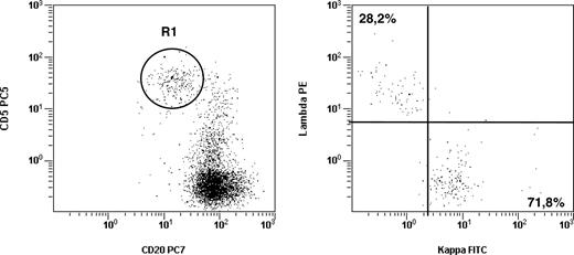 Figure 1. CLL-like MBL may show a normal κ/λ ratio. Flow cytometric analyses from a representative sample from 6 individuals carrying a CLL-like MBL phenotype with a normal (< 3:1 or > 1:3) κ/λ ratio. (A) Dot plot was obtained by gating on CD19+ lymphocytes (identified on forward-scatter vs CD19 profiles, not shown). The intensity of CD20 and CD5 is shown on the x-axis and y-axis, respectively. R1 gate indicates the CLL-like MBL cells. (B) Dot plot shows κ and λ light chain expression of the B-cell clone as identified on panel A. All other B-cell populations present in the dot plot (A) are polyclonal (data not shown).