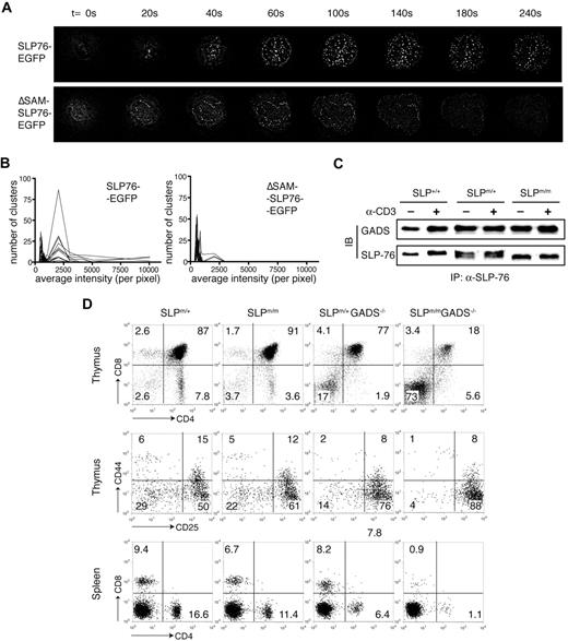 Figure 7. Deletion of the SAM domain inhibits TCR-mediated SLP-76 clustering. (A) J14 cells expressing SLP-76–GFP or ΔSAM–SLP-76–GFP fusion proteins were dropped onto coverslips coated with anti–human CD3ϵ antibody. Time point 0 represents the moment the cells made contact with the coverslip. GFP clustering at the cell/coverslip interface at indicated time points is shown. (B) Cells in panel A were activated on anti-CD3ϵ–coated coverslips for 10 minutes. Average intensity of the GFP clustering formed at the cell/coverslip interface was measured. The numbers of clusters within indicated intensity ranges were counted. Each line represents 1 analyzed cell. (C) Total thymocytes from SLP-76+/+, SLP-76m/+, and SLP-76m/m littermates were either stimulated with anti-CD3ϵ cross-linking or left untreated. Cell lysates were subjected to immunoprecipitation with anti-SLP-76 polyclonal antibody, followed by Western blotting with anti–SLP-76 and anti-Gads antibodies. (D) Thymocytes and splenocytes from 4-week-old SLP-76m/+, SLP-76m/m, Gads−/−, and SLP-76m/mGads−/− mice were analyzed by flow cytometry. (Top) Expression of CD4 versus CD8 on total thymocytes. (Middle) Expression of CD25 versus CD44 on CD4−CD8− DN thymocytes. (Bottom) Expression of CD4 versus CD8 on splenocytes.