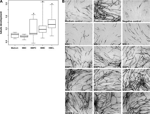 Figure 4. Induction of in vitro angiogenesis. Endothelial cell growth in the AngioKit model. (A) Box plot summarizing the ELISA results. Unlike those of MBC supernatants of BMPCs, pMMCs and HMCLs show a significant induction of tubule formation compared with medium control. *Significant difference compared with medium control (P < .05). (B) Immunostaining with monoclonal anti-human CD31 antibody: medium control (RPMI 1640), positive control (VEGF), negative control (suramin) as well as supernatants of memory B-cell samples (MBC1-3), normal bone marrow plasma cell samples (BMPC1-3), primary myeloma cell samples (pMMC1-3), and the myeloma cell lines SKMM-2, XG-10, and U266. Original magnifications ×40.