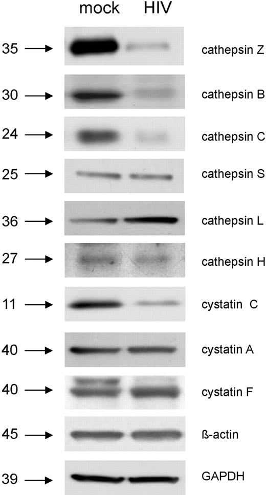 Figure 5. Determination of lysosomal enzyme levels in response to HIV-1 infection by Western blot. Day-6 immature MDDCs were exposed to HIV-1BaL (MOI 10) or mock treated for 48 hours. The relative quantities of lysosomal enzymes present in HIV-1–treated cells compared with mock were then determined by Western blot. Both GAPDH and beta actin were used as loading controls.