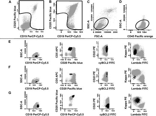 Figure 1. Immunophenotypic identification of peripheral blood B-cell clones in otherwise healthy adults. Top panels (A-D) illustrate the sequential gating strategy used to identify B cells in one representative sample: in a first acquisition step, a gate was drawn on the cell fraction positive for CD19 and/or CD20 (A); information from only those events included in this gate was stored in a second step for more than 5 × 106 total leukocytes (B); finally only those events included in a wide gate drawn on a FSC/SSC and CD45 versus SSC dot plots, corresponding to small and eventually large CD45hi lymphocytes, were selected as B cells (C-D). Illustrative examples of 3 different samples displaying aberrant/clonal B cells are shown in panels E through G (aberrant/clonal B cells are shown as black dots, and residual polyclonal B cells are shown as gray dots): CLL-like cells present at low frequencies (0.01% of the whole cellularity of the sample and 0.7% of the whole B-cell population) are shown in panel E and CLL-like cells present at very low frequencies (0.0015% of the whole cellularity and 0.1% of the whole B-cell population) are displayed in panel F; non–CLL-like B cells proven to be clonal by polymerase chain reaction are shown in panel G.