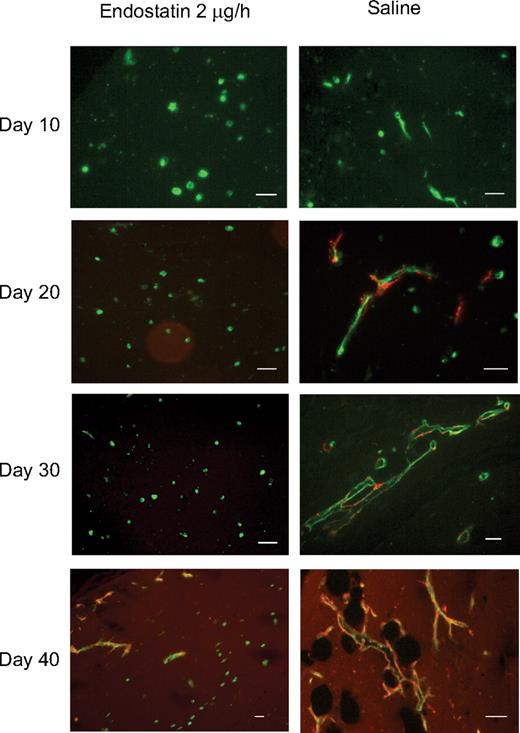 Figure 2. Endostatin inhibits capillary morphogenesis. Immunofluorescence staining for α-smooth muscle actin (red) and Ulex lectin-staining (green) of Matrigels from endostatin-treated and control animals. Note the few pericyte-covered vessels in endostatin-treated animals after 40 days. Scalebars, 50 μm.