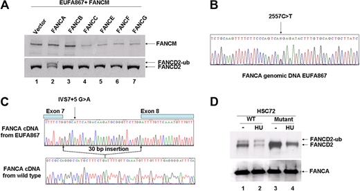 Figure 1. EUFA867 has biallelic FANCA mutations. (A) Introduction of FANCA in EUFA867 lymphoblasts stably expressing FANCM restores FANCD2 monoubiquitination. EUFA867 lymphoblasts were transduced with SF91-FANCM to obtain EUFA867 + FANCM. Subsequently these cells were transduced with bicistronic retroviruses encoding the indicated FA proteins. Cells were treated with 2 mM HU for 16 hours and immunoblotted for FANCD2 and FANCM. (B) EUFA867 has a nonsense mutation 2557C>T (R853X) in FANCA. (C) Mutation IVS7 + 5G>A affects the normal splice donor in FANCA intron 7 and results in a 30-bp insertion of intron 7 sequence in the cDNAs of EUFA867 and her mother. The sequence shown is from an isolated cDNA clone of EUFA867. (D) FANCA cDNA derived from the IVS7 + 5G>A mutation does not correct FANCD2 monoubiquitination. FANCA-deficient HSC72 lymphoblasts were transduced with bicistronic retrovirus encoding either wild-type FANCA or the FANCA mutant derived from the mutation IVS7 + 5G>A. Cells were treated with 1 mM HU to stimulate FANCD2 monoubiquitination.