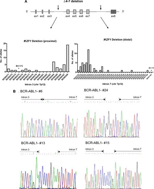 Figure 3. IKZF1 Δ4-7 breakpoints. (A) Schematic representation of Δ4-7 deletion with arrows indicating the region in which the breakpoints occur. In the graphs are shown the chromosome positions of breakpoints in the proximal (intron 3) and distal (intron 7) regions. The most frequent breakpoints occur at 50380384 and 50380388 in the proximal region and at 50431125 and 50431128 in the distal region. Primers used were D1 and D2 (supplemental Table 2); products were then directly sequenced to characterize the sequence flanking deletion breakpoints. (B) Pherograms of sequencing of IKZF1 Δ4-7 breakpoints. Regions matching the reference genomic IKZF1 sequence are shown by arrows, separated by additional nucleotides not matching the consensus sequence.
