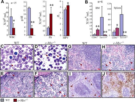 Figure 1. Significant thrombocytosis in c-Myc−/− mice. (A) Decreased WBC and hemoglobin concentration but significantly increased platelets in PB of c-Myc−/− mice. Enlarged platelet size in c-Myc−/− mice is shown as mean platelet volume (MPV). (B) Significant increase in the absolute number of CD41+ megakaryocytes but reduction in Ter119+ nucleated erythrocytes in both BM (2 hind limbs) and spleens of c-Myc−/− mice compared with their age- and gender-matched WT controls. (C-D) PB smears (Wright-Giemsa staining 100×/1.3) show increased platelets in c-Myc−/− mice. (E-J) Increase in megakaryocyte numbers in c-Myc−/− BM (F) and spleens (H,J), compared with WT BM (E) and spleens (G,I), as shown by hematoxylin and eosin staining (40×/0.8 air; E-H) and confirmed by megakaryocyte-specific AChE staining (20×/0.7 air) oil (I,J). *P < .05; **P < .01.