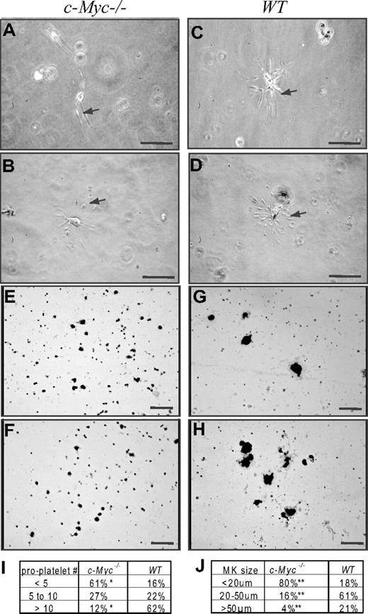 Figure 4. The percentage of small-sized megakaryocytes, which produce fewer numbers of proplatelets, was increased in c-Myc−/− mice compared with WT controls. BM nucleated cells from c-Myc−/−and WT control mice were seeded at a final concentration of 5 × 105/mL in MegaCult-C Collagen-Medium (StemCell Technologies) supplemented with 50 ng/mL rh TPO,10 ng/mL rm IL-3, 20 ng/mL rh IL-6, and 50 ng/mL rh IL-11. Cells were incubated at 37°C, 5% CO2. The megakaryocyte maturation process was observed 48 hours later. We found that significant numbers of megakaryocytes had matured, as indicated by the development of proplatelet projections and, later (A,C) by platelet production (B,D). Shown are representative photomicrographs of megakaryocytes from c-Myc−/−mice (A-B) and WT control mice (C-D). Based on the number of proplatelet projections, megakaryocytes were classified into 3 groups as summarized in panel I. We found that the percentage of megakaryocytes producing fewer proplatelets (< 5) was significantly increased, whereas the percentage of megakaryocytes producing larger numbers of proplatelets (> 10) was significantly decreased in c-Myc−/− mice compared with WT controls. A total of 83 and 95 megakaryocytes were counted in c-Myc−/− and WT control mice, respectively. Megakaryocytes were confirmed by AChE staining as shown in panels E to H. Megakaryocytes cultured as described in panels A to D were harvested 72 hours after incubation and stained with AChE. Shown are representative photomicrographs of AChE-positive megakaryocytes from c-Myc−/− (E-F) and WT control mice (G-H). The size of AChE-positive megakaryocytes was measured. Based on diameter, megakaryocytes were classified into 3 groups as summarized in panel J. *Significant difference compared with WT control mice. Bar represents 100 μm. Panels A-D, 40×/0.8 air; panels E-H, 20×/.7 air.
