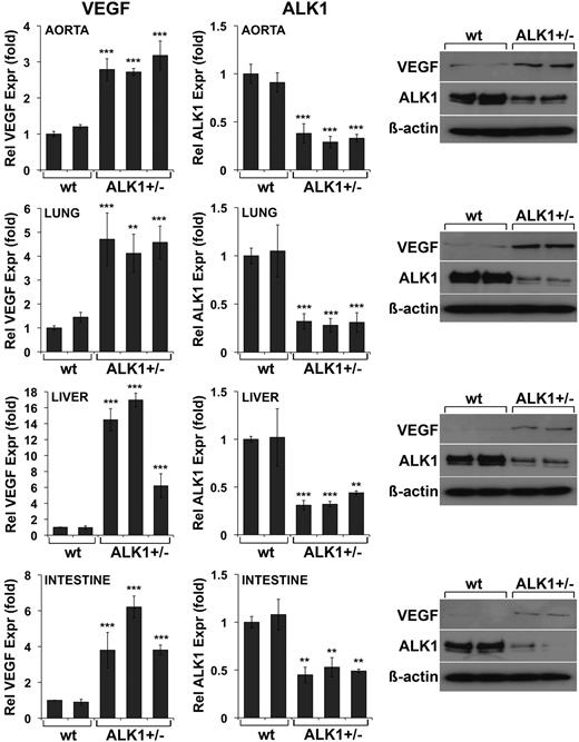 Figure 5. Tissue expression of VEGF is elevated in ALK1+/− mice. RNA and protein were prepared from aorta, lungs, liver, and intestine from wild-type (wt) and ALK1+/− mice. Expression of VEGF and ALK1 was determined by real-time PCR and immunoblotting. Asterisks indicate statistically significant differences compared with control (wt). **P < .01; ***P < .001; Tukey test.