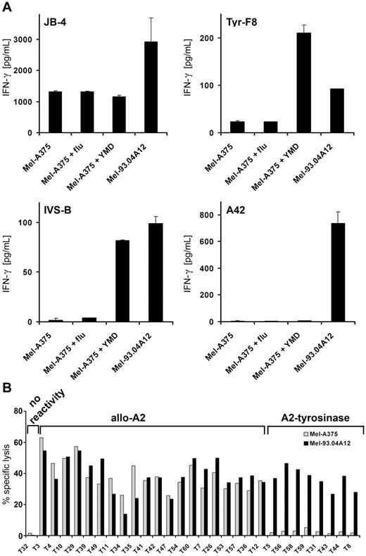 Figure 2. Recognition of peptide-loaded Mel-A375 and exemplary screening data from the DC priming. (A) HLA-A2+tyrosinase− Mel-A375 were exogenously loaded with irrelevant flu peptide, the tyrosinase-peptide YMD, and compared with HLA-A2+tyrosinase+ Mel-93.04A12 for capacity to stimulate CTLs. IFN-γ secretion of the tyrosinase-independent HLA-A2 allo-reactive T-cell clone (JB4), 2 HLA-A2–restricted tyrosinase peptide–specific T-cell clones (Tyr-F8 and IVS-B), and an HLA-A2–restricted melan-A peptide–specific T-cell clone (A42) was measured by ELISA and given as picograms per milliliter. (B) Exemplary screening data of clones derived from a priming using DCs derived from an HLA-A2− donor loaded with HLA-A2 and tyrosinase RNA. Cytotoxic activity was assessed in a standard 4 hours chromium release assay using HLA-A2+tyrosinase− Mel-A375 and HLA-A2+tyrosinase+ Mel-93.04A12 melanoma cells as target cells at different E:T ratios. Data are given as percentage-specific lysis.