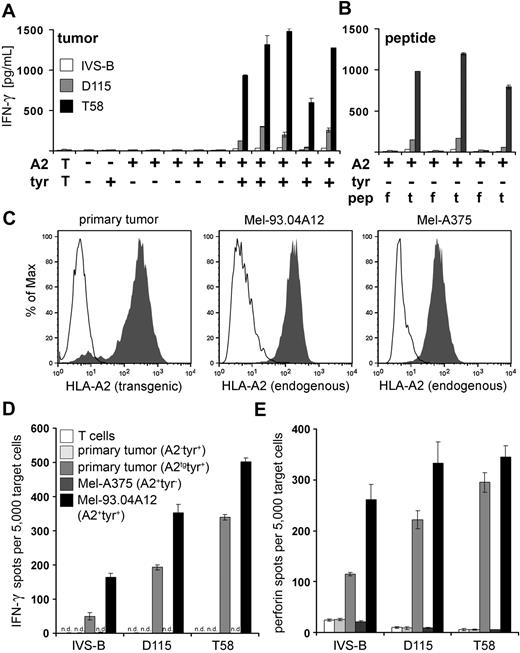 Figure 5. Tyrosinase peptide-specific CTL recognition of tumor cell lines and primary melanoma tumor cells. (A) Columns represent the amount of IFN-γ (picograms per milliliter) secreted by patient-derived IVS-B CTL, self-restricted D115 CTL, and allo-restricted T58 CTL in coculture with a panel of tumor cell lines from left to right: MaCa1 (HLA-A2−tyrosinase−); SK-Mel-28 (HLA-A2−tyrosinase+); Mel-A375, RCC-26, PancTu 1, MaCa1/A2, and UTS CC 1588 (all HLA-A2+tyrosinase−); Mel-624.38, Mel-93.04A12, SK-Mel-23, SK-Mel-29, and WM-266-4 (all HLA-A2+tyrosinase+). T indicates CTL without stimulating cells. (B) The HLA-A2+tyrosinase− tumor cell lines Mel-A375, RCC-26, and MaCa1/A2 were exogenously loaded with either 10−5 M irrelevant flu peptide (f) or 10−5 M tyrosinase peptide YMD (t), and IFN-γ secretion was measured by ELISA and given as picograms per milliliter. (C) HLA-A2 expression on primary tumor cells (passage 12) of an HLA-A2− melanoma patient after transfection with 50 μg HLA-A2 ivt-RNA and on established melanoma cell lines Mel-93.04A12 (HLA-A2+tyrosinase+), and Mel-A375 (HLA-A2+tyrosinase−) was measured by flow cytometry after staining with HLA-A2–specific monoclonal antibody. Histograms represent stained samples (filled curves) and control samples (empty curves): control curves show untransfected primary tumor cells stained with HLA-A2–specific monoclonal (left histogram) or isotype control antibodies used with the melanoma cell lines (middle and right histograms). HLA-A2 expression on primary tumor cells was detected 10 hours after electroporation. (D) The capacity of the patient-derived CTLs (IVS-B), the representative self-restricted CTLs (D115), and the representative allo-restricted CTLs (T58) to secrete IFN-γ or (E) release perforin in coculture with the melanoma cells shown above was measured in ELISPOT assays. n.d. indicates not detectable.