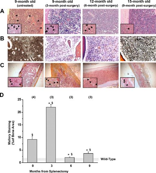 Figure 2. Splenectomy reduces the development of marrow fibrosis and new bone formation in Gata1low/+ mice. (A) Hematoxylin-eosin, (B) Gomory-silver, and (C) Mallory staining of long bones from Gata1low/+ females at different time points after splenectomy, as indicated. Results are compared with those of untreated Gata1low/+ female littermates at 9 months of age. Results are representative of those obtained in multiple experiments. Representative MKs and bony trabeculae are indicated by arrows and arrowheads in the insets, respectively. Magnification is ×20 in the panels and ×40 in the insets. (D) Levels of Mallory staining of the femur of untreated and splenectomized Gata1low/+ mice. Results are presented as mean ± SD determinations of at least 3 mice per experimental group and are compared with those observed in untreated wild-type mice of comparable age (shaded area). The levels of Mallory staining were determined by analyzing with the MetaMorph program at least 3 randomly chosen bone areas per mouse. Values statistically different (P < .05 and P < .01) from those observed in untreated wild-type and Gata1low/+ females are indicated by § and *, respectively.
