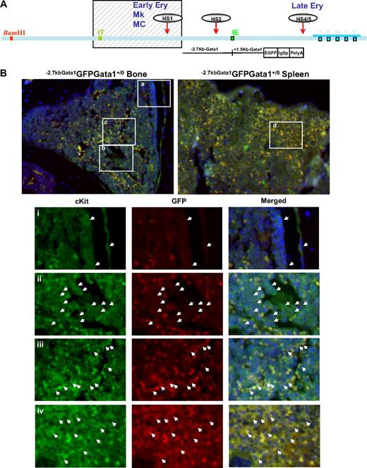 Figure 3. Altered localization of the stem/progenitor cells (cKitpos) within the architecture of the marrow of Gata1low mice. (A) Genomic organization of the murine Gata1 locus indicating the position of the proximal (IE) and distal (IT) promoter and of the HS1 (also known as HS-3.5 and G1HE), the HS2, and the HS4/5 (also known as HS+3.5) enhancer. The shaded box indicates the sequences deleted by the hypomorphic Gata1low mutation. The sequences −2.7 Kb upstream and 1.5 Kb downstream of IE driving the expression of the GFP reporter (−2.7Kb Gata1GFP) are indicated at the bottom (see also Skoda15 and Onodera et al25). (B-C) Double cKit and GFP immunofluorescence analysis of marrow and spleen sections of −2.7KbGata1GPFGata1+/0 (B) and −2.7KbGata1GPFGata1low/0 (C) mice, as indicated. The panels on the top present the merged pictures of representative areas of the bone marrow and spleen at ×20 magnification. The rectangles indicate the areas of the sections shown at higher (×40) magnification on the panels in the bottom. These bottom panels present the fluorescent signal of cKit and GFP captured individually and merged. The arrows track the position of individual cKitpos cells in the different panels. The red arrowhead in panel E indicates a GFPneg MK in proximity to the bone endosteum of the Gata1low mouse. Legend: −2.7KbGata1GPFGata1+/0 mouse: (i) 3 cKitposGFPneg cells, one of which is close to the endosteum; (ii) a cluster of cKitposGFPneg cells in the medulla; (iii) a cluster of cKitposGFPpos cells in the medulla; (iv) a cluster of cKitposGFPpos cells in the spleen. −2.7Kbgata1GPFGata1low/0 mouse: (v) a cluster of cKitposGFPpos cells close to the bone endosteum; (vi) a cluster of cKitposGFPneg cells in the medulla; (vii) a cluster of cKitposGFPpos cells in the spleen.