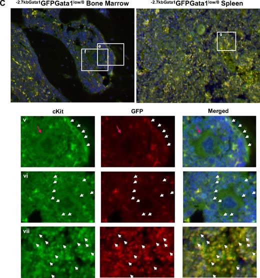 Figure 3. Altered localization of the stem/progenitor cells (cKitpos) within the architecture of the marrow of Gata1low mice. (A) Genomic organization of the murine Gata1 locus indicating the position of the proximal (IE) and distal (IT) promoter and of the HS1 (also known as HS-3.5 and G1HE), the HS2, and the HS4/5 (also known as HS+3.5) enhancer. The shaded box indicates the sequences deleted by the hypomorphic Gata1low mutation. The sequences −2.7 Kb upstream and 1.5 Kb downstream of IE driving the expression of the GFP reporter (−2.7Kb Gata1GFP) are indicated at the bottom (see also Skoda15 and Onodera et al25). (B-C) Double cKit and GFP immunofluorescence analysis of marrow and spleen sections of −2.7KbGata1GPFGata1+/0 (B) and −2.7KbGata1GPFGata1low/0 (C) mice, as indicated. The panels on the top present the merged pictures of representative areas of the bone marrow and spleen at ×20 magnification. The rectangles indicate the areas of the sections shown at higher (×40) magnification on the panels in the bottom. These bottom panels present the fluorescent signal of cKit and GFP captured individually and merged. The arrows track the position of individual cKitpos cells in the different panels. The red arrowhead in panel E indicates a GFPneg MK in proximity to the bone endosteum of the Gata1low mouse. Legend: −2.7KbGata1GPFGata1+/0 mouse: (i) 3 cKitposGFPneg cells, one of which is close to the endosteum; (ii) a cluster of cKitposGFPneg cells in the medulla; (iii) a cluster of cKitposGFPpos cells in the medulla; (iv) a cluster of cKitposGFPpos cells in the spleen. −2.7Kbgata1GPFGata1low/0 mouse: (v) a cluster of cKitposGFPpos cells close to the bone endosteum; (vi) a cluster of cKitposGFPneg cells in the medulla; (vii) a cluster of cKitposGFPpos cells in the spleen.