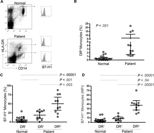 Figure 3. B7-H1 is expressed by CD14+HLA-DRlo monocytes in CTCL. (A-B) PBMCs from both normal donors (n = 23) and CTCL patients (n = 11) were stained with anti-CD14, anti–HLA-DR, and either an isotype control (closed histogram) or anti–B7-H1 (open histogram). The representative dot plot shown demonstrates a unique population of CD14+HLA-DRlo cells present in CTCL patients. The frequency (percentage of total PBMCs) of HLA-DRlo monocytes for normal donors and CTCL patients is shown in panel B. B7-H1 expression by the gated populations shown in panel A was determined. (C-D) B7-H1 expression (compared with an isotype control for each sample) by CD14+HLA-DR+ and CD14+HLA-DRlo cells was analyzed (± 95% confidence interval is shown).
