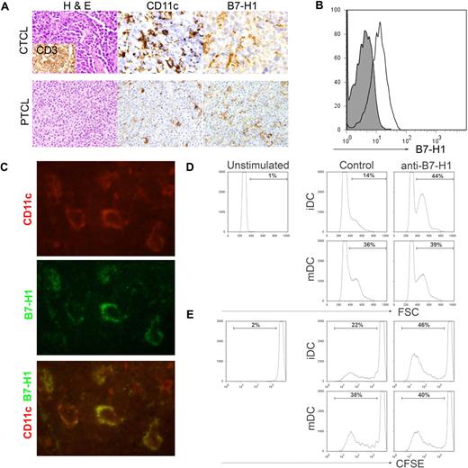 Figure 4. B7-H1 is expressed by tumor-associated DCs and inhibits T-cell proliferation. (A) As described in Figure 1, immunohistochemical staining for B7-H1 was performed in patient biopsy specimens. B7-H1 expression by stromal monocyte-derived cells, identified by CD11c (shown), S-100, or CD68 staining, was determined. (B) Single-cell suspensions were generated from spleen (shown) or lymph node biopsy specimens obtained from PTCL patients (n = 5). Cells were stained with an isotype control (closed histogram) or anti–B7-H1 (open histogram) and B7-H1 expression on CD11c+CD14− DCs determined. A representative example is shown. (C) Tissue specimens obtained from PTCL patients (n = 7) were double stained with antibodies to human CD11c (red) and B7-H1 (green) and viewed by fluorescent microscopy, as described in “Patient samples, immunohistochemistry, and immunofluorescence assay.” A representative example is shown (original magnification ×100). (D-E) Immature or LPS-matured DCs (4 × 105/well) generated from normal-donor monocytes were cocultured with allogeneic, CFSE-labeled T cells (4 × 106/well) for 6 days in the presence of an isotype control or anti–B7-H1 (4 μg/mL), as shown. T-cell activation, demonstrated by increasing forward scatter (D), and proliferation, indicated by CFSE dilution (E), were analyzed. The data shown are representative of at least 3 similarly performed experiments.