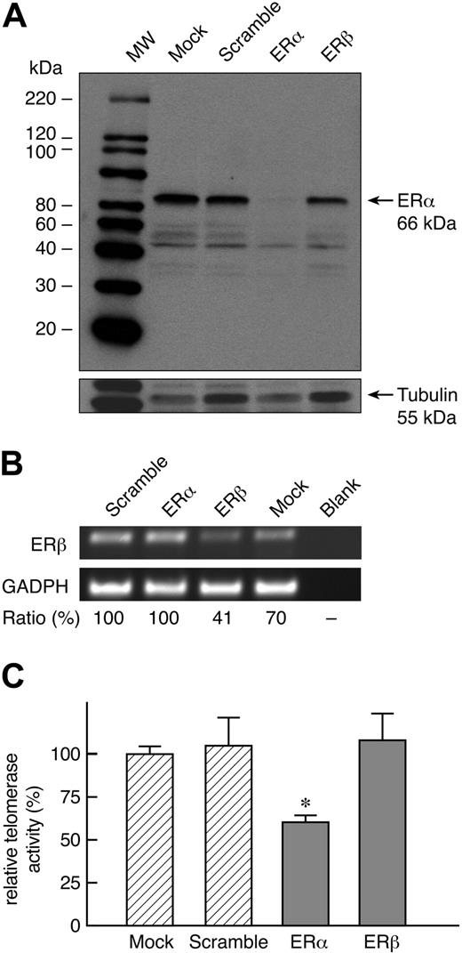Figure 4. siRNA “knockdown” of ERα but not ERβ abrogates increased telomerase activity induced by estrogen. In 5 separate experiments, peripheral blood lymphocytes were transfected with either scramble siRNA, siRNA for ERα (ESR1), for ERβ (ESR2), or no siRNA at all (mock) and cultured for 3 days in the presence of PHA, IL-2, and E2 (1 μM). (A) Representative Western blot indicates that siRNA effectively knocked down ERα expression (> 85%). (B) RT-PCR of a representative experiment indicates that siRNA also knocked down ERβ (59% reduction). (C) Reduction in ERα expression correlated with significant decrease in telomerase activity (*P < .05).