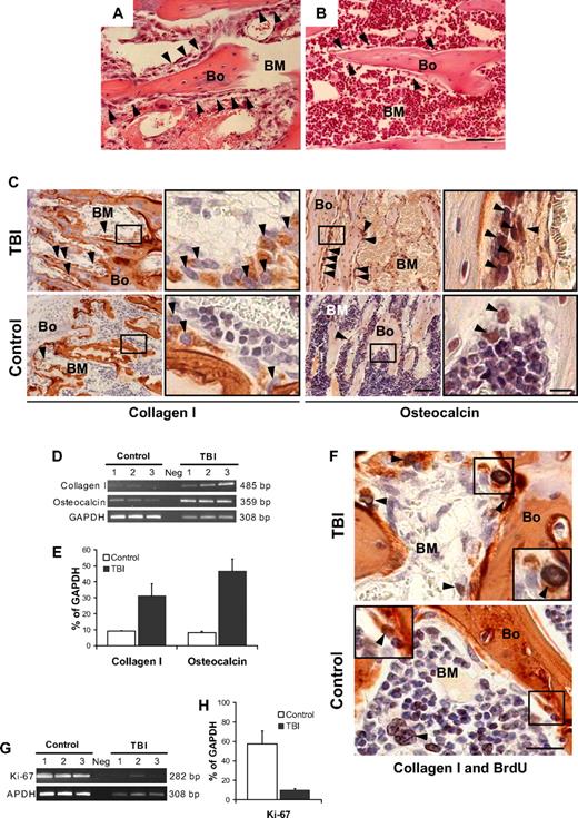 Figure 1. Osteoblast proliferation after marrow radioablation. (A) Bone (Bo) and BM section taken from a metaphysis at 48 hours after TBI shows an increased number of cells lining the bone () compared with (B) the nonirradiated control (hematoxylin-and-eosin stain). (A,B) Scale bar represents 50 μm. (C) Immunohistochemical staining (in red) to identify the bone-lining cells in panels A and B revealed an increase of collagen I (left) and osteocalcin (right) producing osteoblasts (). Scale bar (third column) represents 50 μm; scale bar (fourth column) represents 10 μm. (D) Semiquantitative RT-PCR analysis confirming an increased expression of collagen I and osteocalcin in TBI mice. The negative control (Neg, without template) is shown in the middle lane. (E) Comparison of transcript band intensities, for genes encoding collagen I and osteocalcin, expressed in irradiated and nonirradiated mice. The values were calculated relative to GAPDH levels and reported as mean percentages (± SD) of 6 mice per group. Both collagen I (P = .01) and osteocalcin (P = .001) levels are significantly increased over control values (Student t test). (F) Double staining of sections from TBI and control mice with anti-BrdU (black) and anticollagen I (red) antibodies. The typical nuclear pattern of the BrdU labeling and the simultaneous collagen I expression () demonstrates the presence of proliferating osteoblasts after TBI. The BrdU-positive cells in the control mice are predominantly present in the BM space (), with rare double-positive osteoblasts (inset). Scale bar represents 20 μm. (G) Semiquantitative RT-PCR analysis of Ki-67 expression by marrow cells from TBI and control mice demonstrates the persistence of proliferating BM cells after irradiation. (H) Comparison of transcript band intensities for Ki-67 expressed in irradiated versus nonirradiated mice. Values were calculated relative to GAPDH levels and reported as mean percentages (± SD) of 6 mice per group. Ki-67 expression was significantly decreased (P < .01) but persisted in irradiated mice.