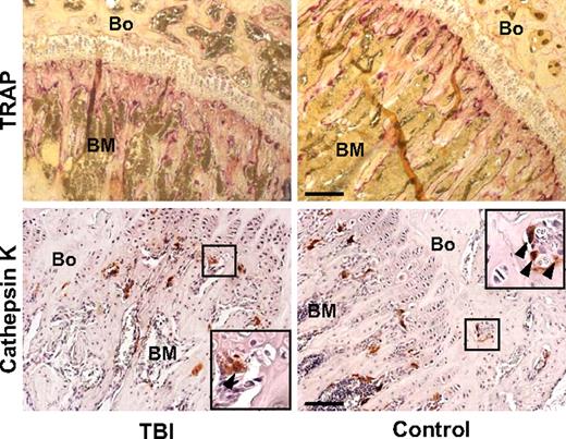Figure 2. Osteoclast compartment staining in irradiated (TBI) and control mice. Photomicrographs of a bone (Bo) and BM section from the metaphysis stained with tartrate-resistant acid phosphatase (top; purple) and with anti–cathepsin K antibody (bottom; red), as 2 reliable osteoclast markers. Staining intensities did not differ appreciably between the 2 groups. Scale bar (top) represents 200 μm; scale bar (bottom) represents 100 μm.