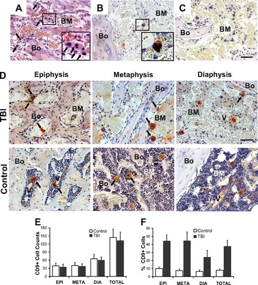 Figure 3. Irradiation and marrow distribution of host surviving megakaryocytes. (A) Bone (Bo) and BM section of a metaphysis taken at 48 hours after irradiation. Among the residual stromal cells and osteoblasts are large cells () with large multilobulated nuclei that appear as megakaryocytes (inset). (B) Immunohistochemical staining with anti-CD9 (red) and anti-BrdU (black) antibodies confirms the presence of physiologically active megakaryocytes after TBI. The inset represents an enlarged image of the results of CD9 and BrdU double staining. (C) Bone section stained with isotype control primary antibody. (D) Specific pattern of megakaryocyte distribution in response to TBI as revealed by staining for CD9 (red). After radioablation, megakaryocytes () can be found in close contact with the bone-lining cells, whereas in the control they are located primarily in the central areas of the BM, often in close proximity to the vessels (V). (A-D) Scale bar represents 50 μm. (E) Total CD9+ multilobulated megakaryocyte counts in the epiphysis, metaphysis, diaphysis, and total marrow space of control versus irradiated mice (n = 4). Mean (± SD) values for randomly selected 200× fields (288 sections scored for each group) are shown. Differences between the control and irradiated groups are not significant (P > .05). (F) Mean percentages (± SD) of CD9+ multilobulated megakaryocytes in contact with the cells lining the bone in control versus irradiated mice (n = 4). Percentages of bone-associated megakaryocytes were significantly higher in irradiated mice in all 3 major bone regions (P ≤ .01), with the epiphysis and metaphysis both showing greater accumulations of megakaryocytes at the bone surface than was apparent in the diaphysis (P < .001).