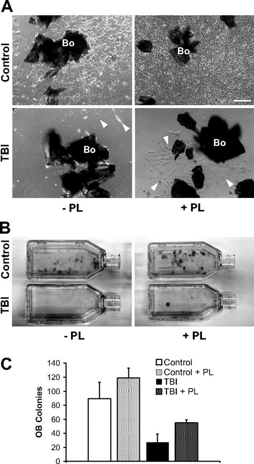 Figure 5. Isolation of irradiated osteoblasts from megakaryocyte-conditioned marrow microenvironment. (A) Representative photomicrographs of in vitro–cultured osteoblasts selectively obtained from bones (Bo) in control (n = 6) and irradiated (TBI; n = 6) mice. The bones are harvested and completely depleted of hematopoietic marrow fraction. Left panels represent nonirradiated control (top) and irradiated (bottom) samples after 7 days of culture without PL (−PL). Osteoblasts in control samples begin to proliferate generating an adherent cell layer; conversely, after TBI the separation of irradiated osteoblasts () from marrow microenvironment is followed by a defective in vitro behavior. The addition of PL (+PL, right) increased the proliferation of osteoblasts from controls (top right) as well as from the irradiated animals (bottom right). Osteoblasts are indicated (). Scale bar represents 200 μm. (B) Representative pictures of osteoblast colonies from irradiated or control mice, after 2 weeks in culture with or without PL. (C) In vitro osteoblast colony count (per 200 mg processed bone chips) from irradiated and control mice, with or without PL. A reduction of the average colony number is observed after irradiation (89.2 ± 23.7 vs 27 ± 12, P = .006), indicating a damage that is not restored because of the absence of megakaryocyte-derived growth factors in the cultures. PL was able to significantly increase the colony number both in control samples (89.2 ± 23.7 vs 118.7 ± 14.4, P = .04) and after TBI (27 ± 12 vs 55 ± 4.3, P = .03). Experiments were performed at least in triplicate.