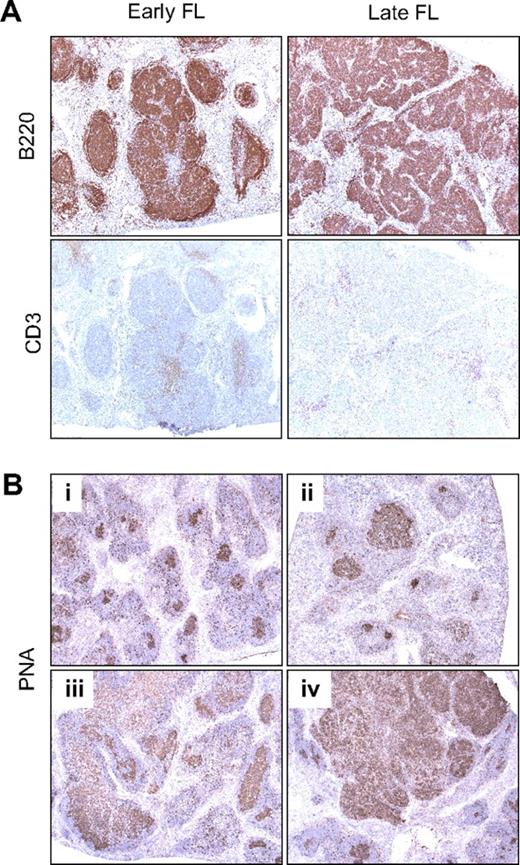 Figure 4. Lymphomas in (CD27;)CD137L−/− mice are of GC B-cell origin. (A) Immunohistochemistry of spleen sections of mice diagnosed with early-stage and late-stage FL by the use of antibody to B220 to detect B cells and antibody to CD3 to detect T cells (serial sections). (B) Histochemistry with PNA was performed to define GC B cells. Shown are spleen sections of mice diagnosed with different stages of FL development: (i) healthy aged WT control, (ii) preneoplastic lesions, (iii) early-stage FL, and (iv) late-stage FL. Original magnification (panels A-B) ×5. Specific staining is shown in brown and hematoxylin counterstaining in blue.