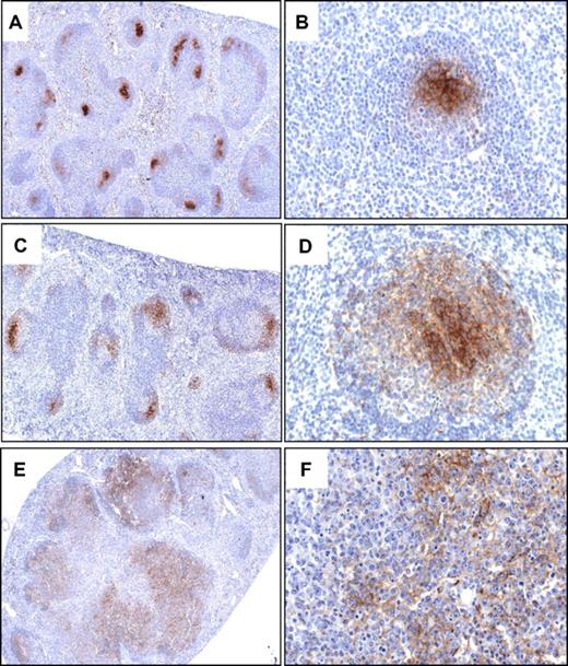 Figure 5. Transformed GC B cells in CD27;CD137L−/− mice expand within a FDC network. Immunohistochemical detection of FDCs with antibody to the marker MFG-E8 in representative spleen sections of a 12-month-old WT mouse (A-B), a 10-week-old mouse at day 8 after infection with influenza virus (C-D), and a representative mouse (n = 5) diagnosed with early-stage FL (E-F). Original magnifications, ×5 (A,C,E); ×40 (B,D,F). Specific staining is shown in brown and hematoxylin and eosin counterstaining in blue.