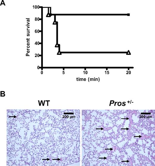 Figure 4. TF-induced venous thromboembolism model. (A) Anesthetized mice were injected intravenously with recombinant TF (1/8 dilution of Innovin in 0.9% NaCl; 2 μL/g body weight) via the inferior vena cava. The time to the onset of respiratory arrest that lasted at least 2 minutes was recorded for WT (■; n = 8) and Pros+/− (△; n = 8) mice. Experiments were terminated at 20 minutes. Pros+/− mice showed higher mortality than WT mice (P = .02), and 87.5% WT mice and 25% Pros+/− mice survived the TF challenge. (B) In the low-TF challenge and 2 minutes after onset of respiratory arrest or at the completion of the 20-minute observation period, lungs were excised and stained with H&E. Pros+/− mice that died within the 20-minute observation period had an increased number of thrombi (arrows, right panel), compared with WT mice that survived the TF challenge (left panel).