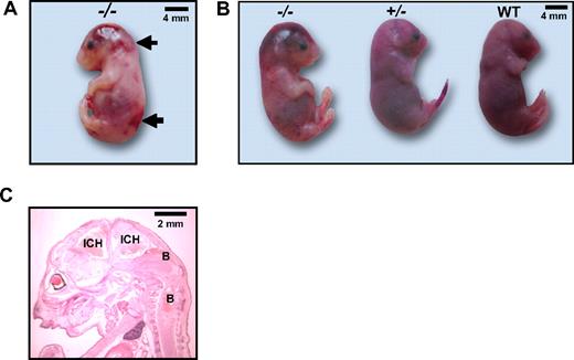 Figure 5. Macroscopic examination of homozygous E17.5 Pros−/− embryos. (A) Most E17.5 Pros−/− embryos were found dead when harvested, and were severely bruised in the head (left panel), together with localized signs of bleedings and/or thrombosis throughout the body, especially on the back (arrows). (B) E17.5 Pros−/− embryos did not show any differences in development and gross anatomy with E17.5 Pros+/− or WT embryos. (C) Extensive intracranial hemorrhages (ICH) and secondary bleedings localized throughout the body (B) were visible in macroscopic histologic analysis of a whole section of E17.5 Pros−/− embryos.